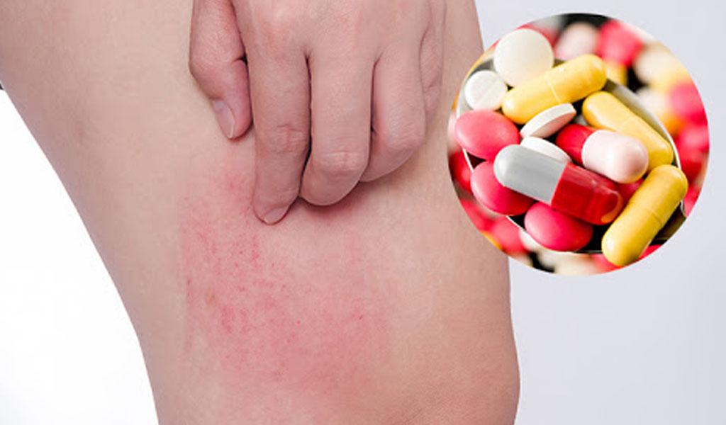 Phản ứng thuốc hoặc tác dụng phụ