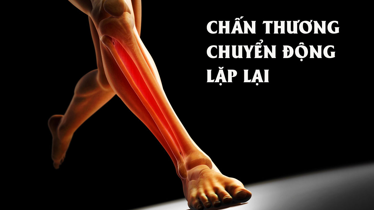 Chấn thương chuyển động lặp lại