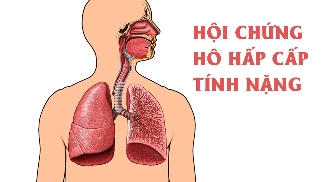 Hội chứng hô hấp cấp tính nặng (SARS)
