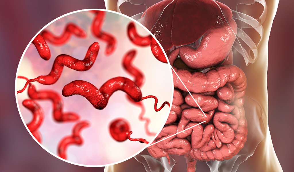 Vi khuẩn Campylobacter