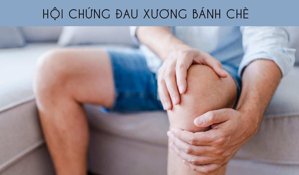 Hội chứng đau xương bánh chè