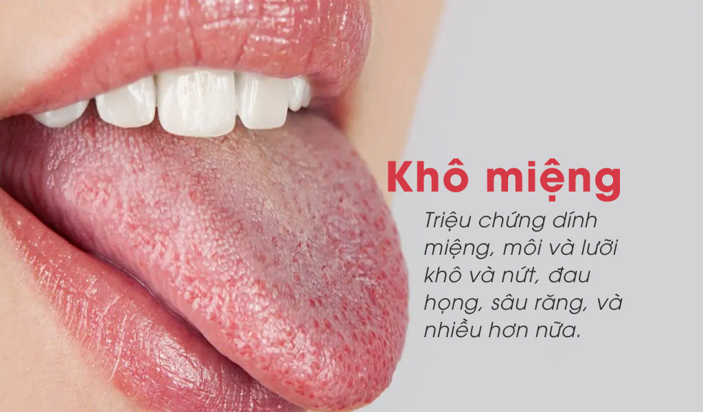 Khô miệng