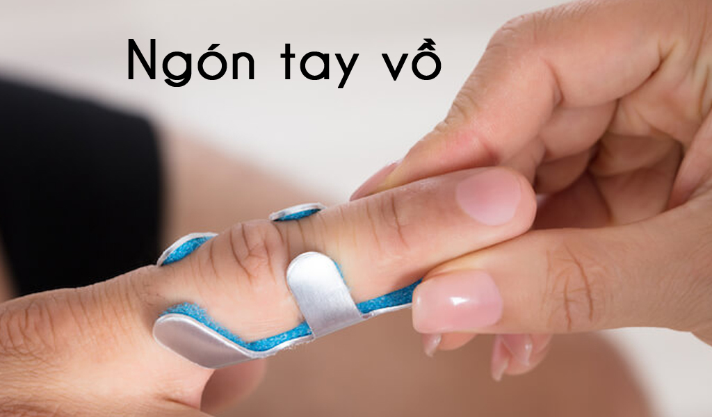 Ngón tay vồ
