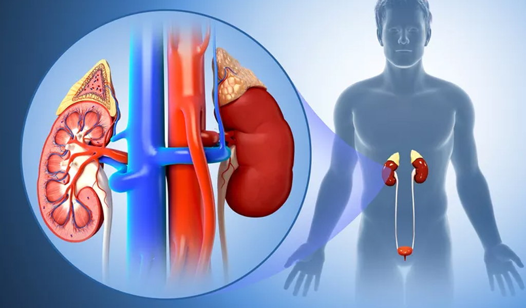 Nhiễm trùng thận (viêm bể thận)