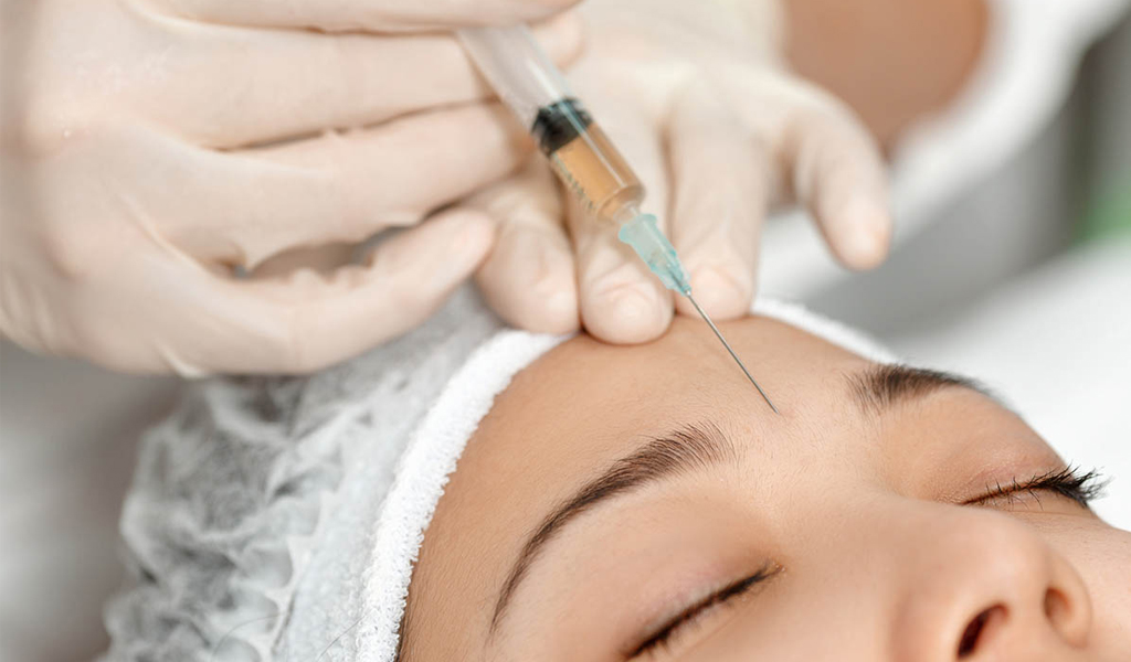 Tiêm độc tố Botulinum (Botox)