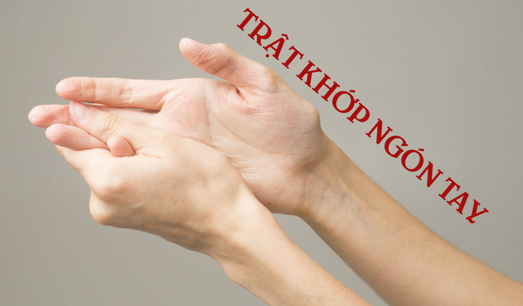 Trật khớp ngón tay