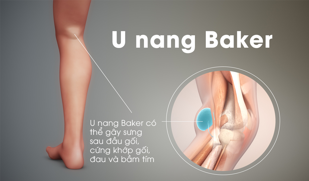 U nang Baker