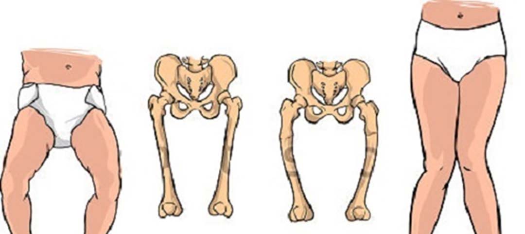 Sự phát triển hệ xương ở trẻ.