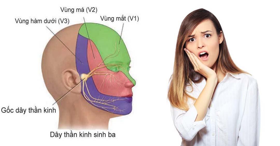 Triệu chứng thường là đau ở vùng da mặt, hàm, mũi trán, trán