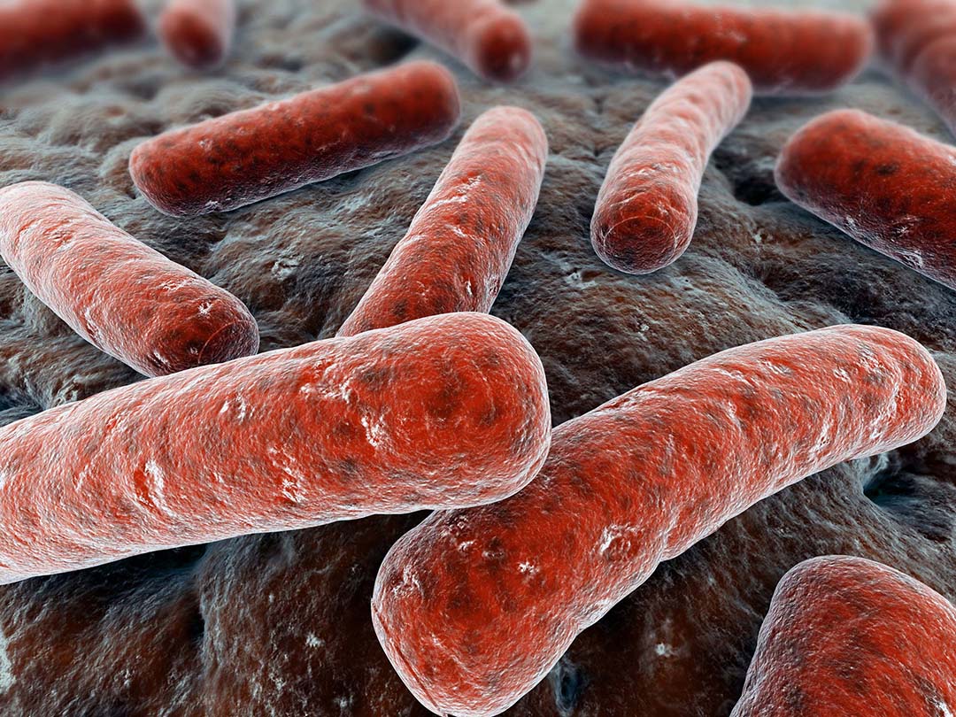 Do vi khuẩn lao người, đôi lúc có thể gặp vi khuẩn lao bò.